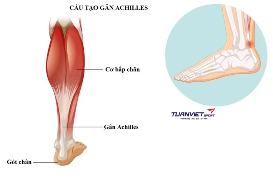 Nguyên nhân đau gót chân khi chơi pickleball và cách khắc phục hiệu quả
