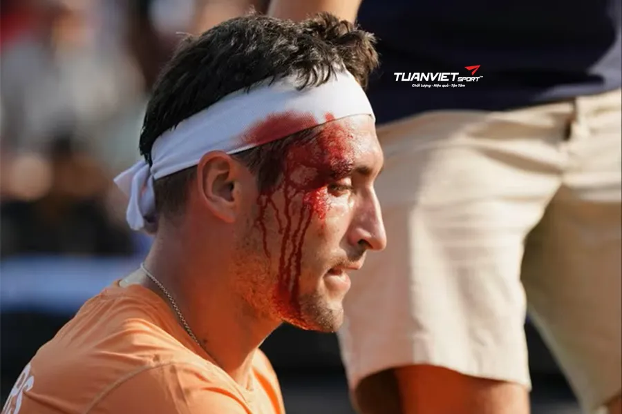 VDV pickleball r&aacute;ch mặt do đồng đội v&ocirc; t&igrave;nh vung vợt